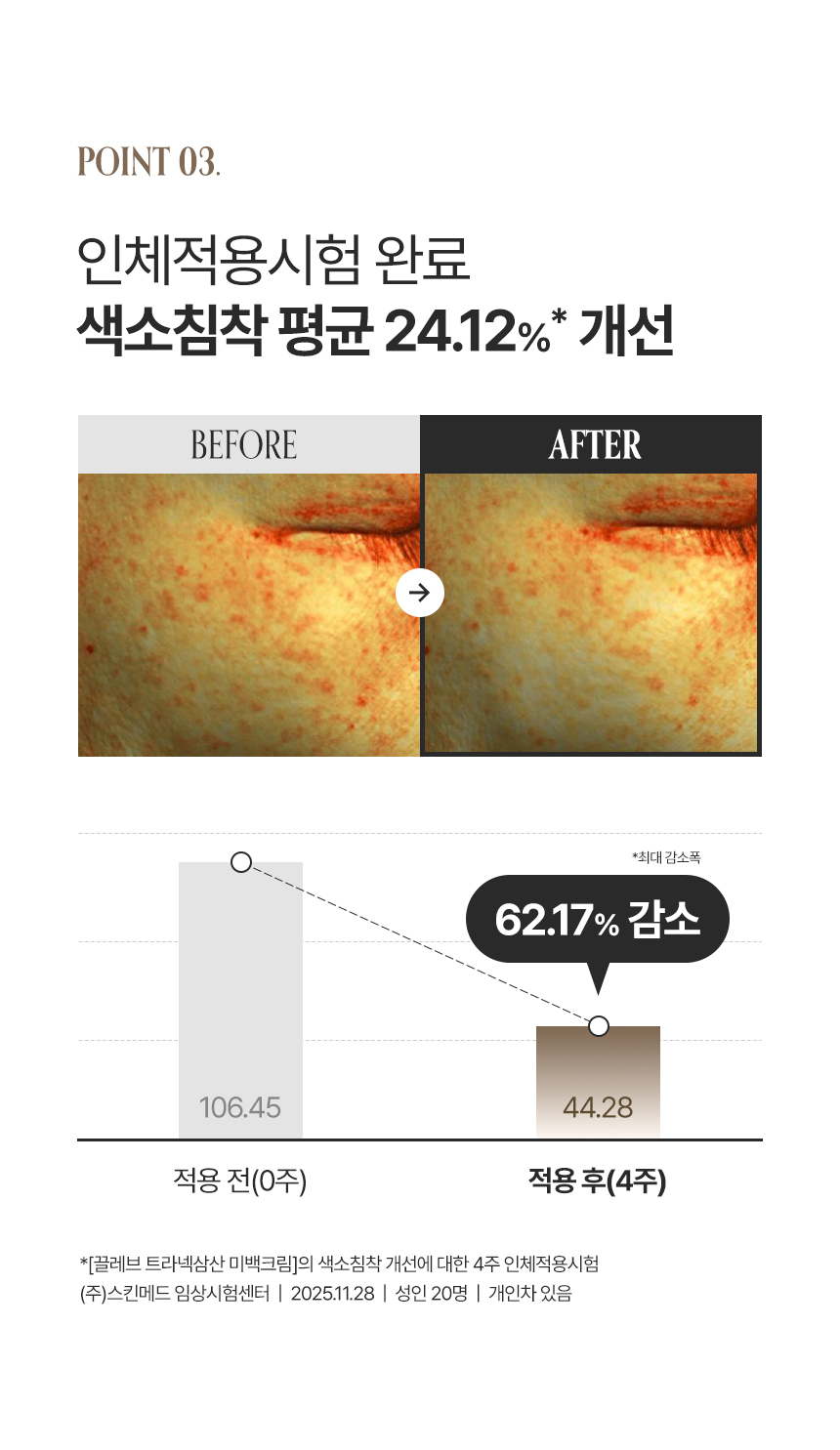 상세페이지 | 끌레브 트라넥삼산 미백크림 — 7
